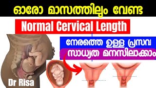 Cervical Length During Pregnancy MalayalamShort CervixCervical Dilation [upl. by Enehs]