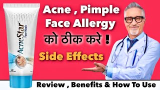 Acne Star Face Wash Review  Benefits amp How To Use [upl. by Nahtnanhoj]