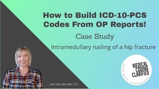 ICD 10 PCS Case study Intramedullary nailing of a hip fracture [upl. by Vanthe]