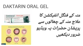 Daktarin oral gel  mouth ulcer medicine  munh ke chhalon ka ilaaj [upl. by Allicsirp989]