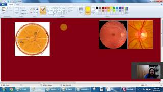 Indirect Ophthalmoscopy Concepts amp MCQ by Dr Anuradha Dhawan [upl. by Anastasius]