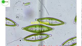 Microscopic world Diatoms Amazing Microscopic Video of algae  seeing the unseen [upl. by Nowahs228]