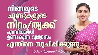 ചുണ്ടുകളിലെ വ്യത്യാസം എന്തിനെ സൂചിപ്പിക്കുന്നു   Dr Jaquline Mathews BAMS [upl. by Garlan733]