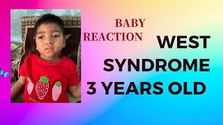 infantile spasms baby infantile spasms baby video west syndrome seizure west syndrome kya hota h [upl. by Ariella]