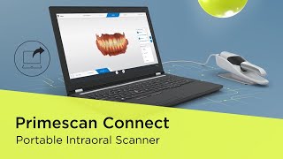 Primescan Connect  Portable Intraoral Scanner [upl. by Eriuqs459]