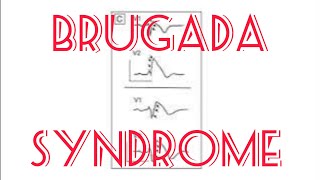 Brugada syndrome  Channelopathy including Short and long QT  Short qt [upl. by Adyam]