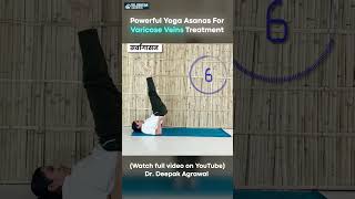 Yoga Exercise for Varicose Vein at Home  Part 10 yogaasanas varicoseveins [upl. by Sirahs34]