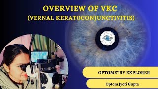 Vernal Keratoconjunctivits VKC VKC [upl. by Winebaum]