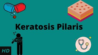 Keratosis Pilaris Causes Signs and Symptoms Diagnosis and Treatment [upl. by Wera]