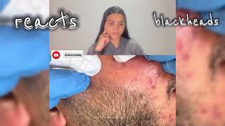 blackheads nose blackheads removal satisfying blackheads removal lips blackheads removal ear [upl. by Evan234]