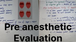 Preanesthetic Evaluation  Anesthesia dene ke Pehle kya kya checkup karte hAllrounderdoctorfalit [upl. by Ardnasyl545]