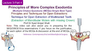 Lecture 3 Part4 MCQs  Technique for Open Extraction of Multirooted Teeth  Mandibular Molars [upl. by Airotal]