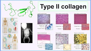 WEBINAR NOW UCII® for Joint Support Webinar  Undenatured Type II Collagen [upl. by Annamaria446]