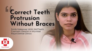 Correct Teeth Protrusion Without Braces  Cosmetic Dentist In Mumbai  SAPTeeth [upl. by Bowie]