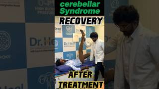 Stroke Recovery After treatment ad viral video fyp [upl. by Rains]