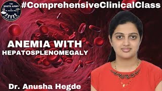 Anemia with Hepatosplenomegaly Case presentation [upl. by Rondi412]