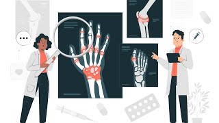 RheumatologyIntroductionpart2marrowmed damsdelhi PrepLaddermedpg dbmciofficial🩺🏥⚕️😷🩻🧑‍⚕️ [upl. by Idelia]