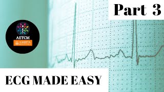 ECG made easy  Part 3  Heart Blocks [upl. by Thedrick]