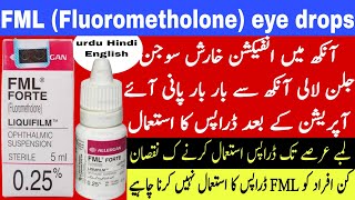 FML eye drops uses  fluorometholone eye drops  corticosteroids eye drops  eye infection treatment [upl. by Odoric]