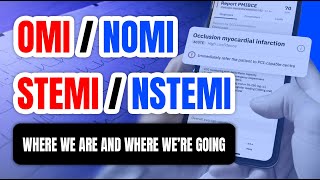 OMINOMI vs STEMINSTEMI  Where We Are and Where Were Going [upl. by Hernardo]