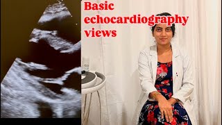 Basic echocardiography viewsechocardiography [upl. by Tigram]