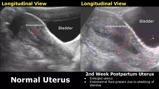 Gynecological amp Obstetric Ultrasound Normal Vs Abnormal Scan  Uterus Ovary Cervix Pregnancy USG [upl. by Luce868]