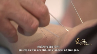 Racine culturelle  Lacupuncture chinoise [upl. by Devaj839]