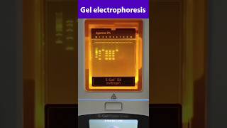 Gel electrophoresis Technique [upl. by Bluma296]