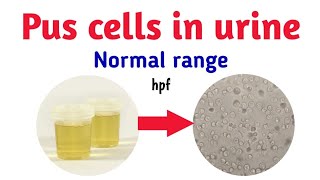 In urine normal range  pus cells  epithelial cells  RBC  albumin  SG  protein  crystals [upl. by Sherry]