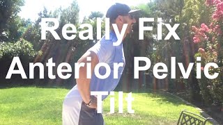 How to Really Fix Anterior Pelvic Tilt Hyperlordosis  Over Extension [upl. by Dej]