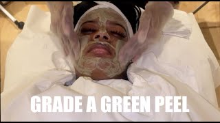 GRADE A GREEN PEEL WITH YEMAYA LONDON BEAUTY REVIEWPROCESS  PEEL WITH ME [upl. by Corb]