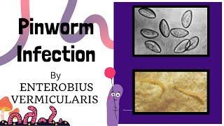 Pinworm Infection Causes and Treatment  Life Cycle of Pinworm Intestinal nematodes Novice Medic [upl. by Arhat]