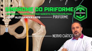 Síndrome do Piriforme  Definição Incidência e Tratamento Fisioterapêutico [upl. by Nataline]