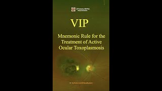 Ocular Toxoplasmosis VIP Mnemonic Rule for the Treatment toxoplasmosis toxoplasmagondii [upl. by Lyrret]