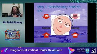 Vertical Ocular Deviations Prof Dalal Shawky  Alexandria University  Egypt [upl. by Novrej]