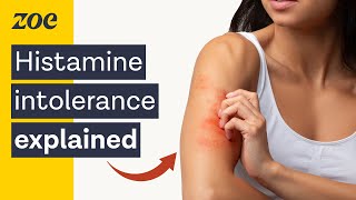 The surprising truth about histamine intolerance  Dr Will Bulsiewicz [upl. by Flo393]