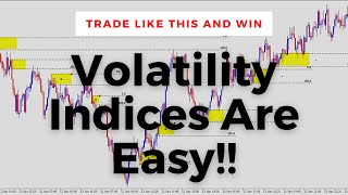 How To Trade Volatility Indices Institutional Trading Strategies [upl. by Ainafetse]