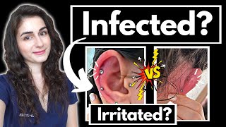 Doctor explains Is your piercing infected How to care for a new cartilage piercing [upl. by Allit]