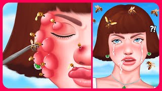 Treatment amp removal of the BEE STINGER stuck in the cute girls face 🐝 Satisfying ASMR Animation [upl. by Kania427]