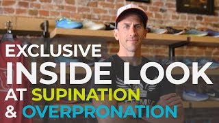 7 Questions on Supination and Overpronation Answered By A Running Expert [upl. by Fates]