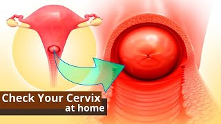 How You Can Check Your Cervix At Home  Best Ways to Know the Dilation of Cervix [upl. by Hausner245]