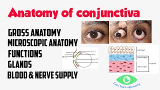 eye conjunctival concretionsocular [upl. by Aicelav190]