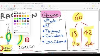 ERRORS OF REFRACTION  MYOPE VS HYPERMETROPE  MNEMONICS [upl. by Cheshire]