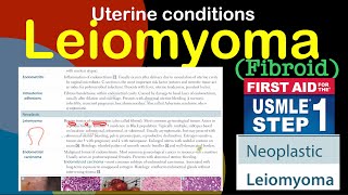 Leiomyoma [upl. by Ettener865]