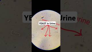 Urine analysisshortvideoshotslike dailyshortstrendinglaboratorylifemedicallaboratorystudents [upl. by Cioban]