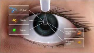 Alcon Dry Eye Video and Systane Ultra Action [upl. by Erbas]