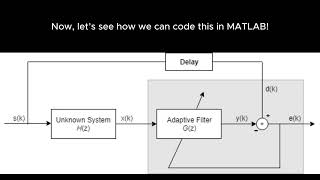 RealTime ECG Noise Removal with MATLAB Adaptive Filtering Explained [upl. by Adnuhsal]