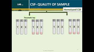 Cerebrospinal fluid Routine Analysis Microbiology Tube 2 [upl. by Trefler]