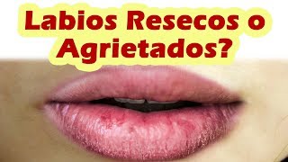 Remedios Caseros Para Labios Resecos o Agrietados COMO QUITAR LO RESECO DE LOS LABIOS [upl. by Akerdnuhs]