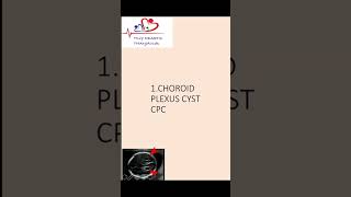 Choroid plexus cyst  Antenatal scan  Downs syndrome choroidplexuscyst [upl. by Lotson]